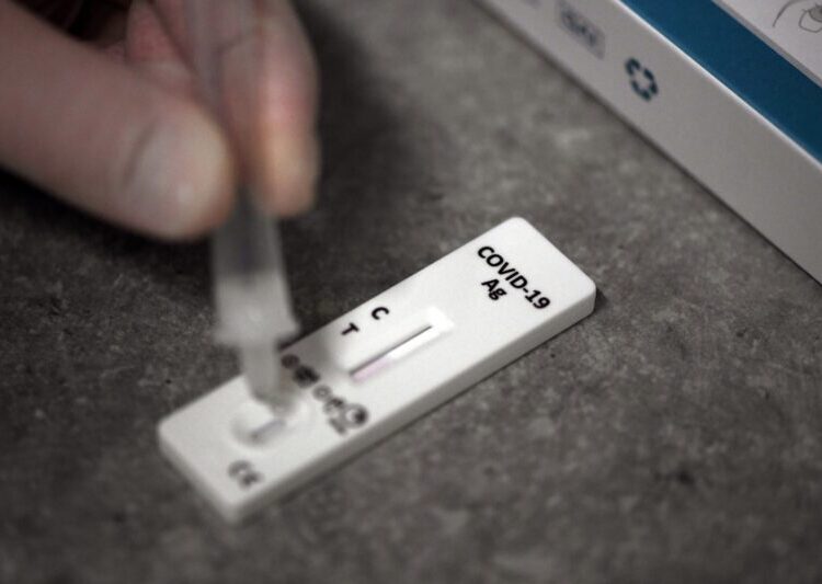 An employee demonstrates the application of a NADAL Covid-19 rapid test during a smear test at the distribution centre of nal von minden, a company distributing antibody and antigen rapid tests, in Moers, western Germany on March 4, 2021, amid the ongoing coronavirus Covid-19 pandemic. (Photo by Ina FASSBENDER / AFP)
