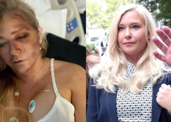 Virginia Giuffre, plaignante de l&rsquo;affaire Epstein, dans un « état grave » après un accident